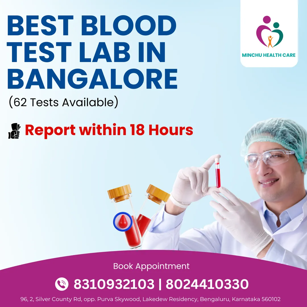 Best Blood Testing Lab in Bangalore