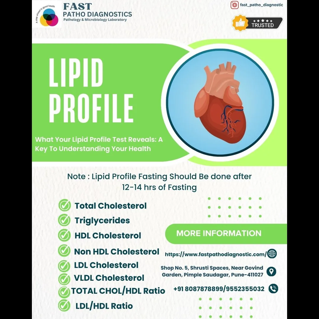 LIPID PROFILE
