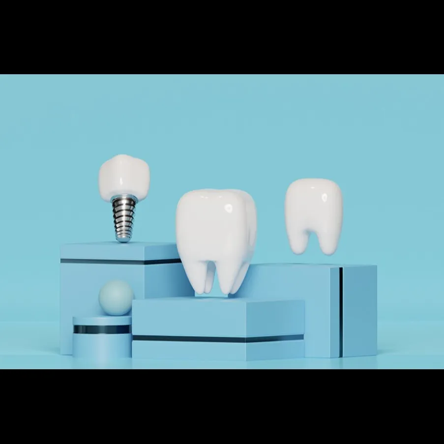 Dental Implant Journey: Understanding Each Stage for Successful Tooth Replacement in Lajpat Nagar