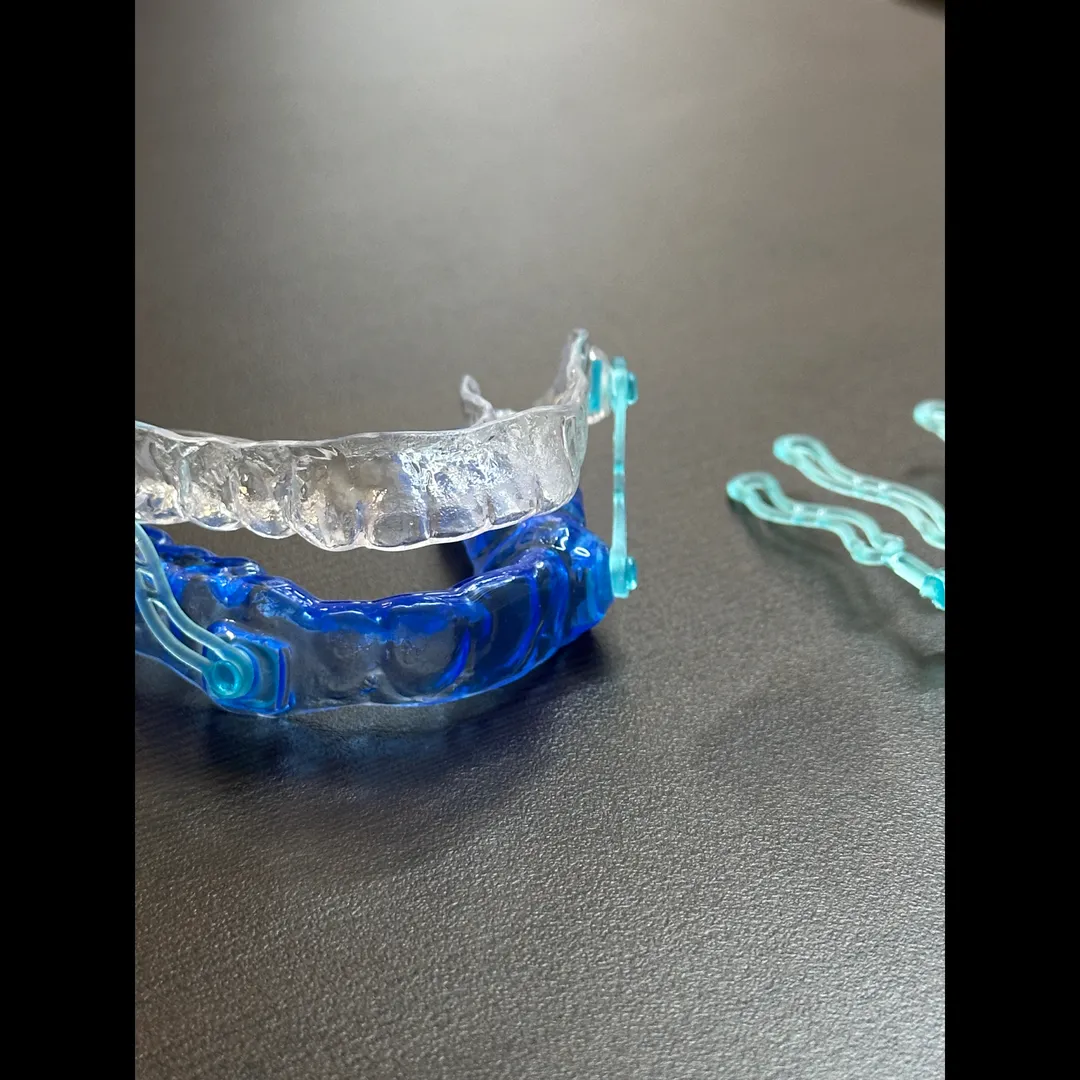 Anti Snoring Device Treatment in Chennai | Stop Snoring with Comfortable Oral Appliance