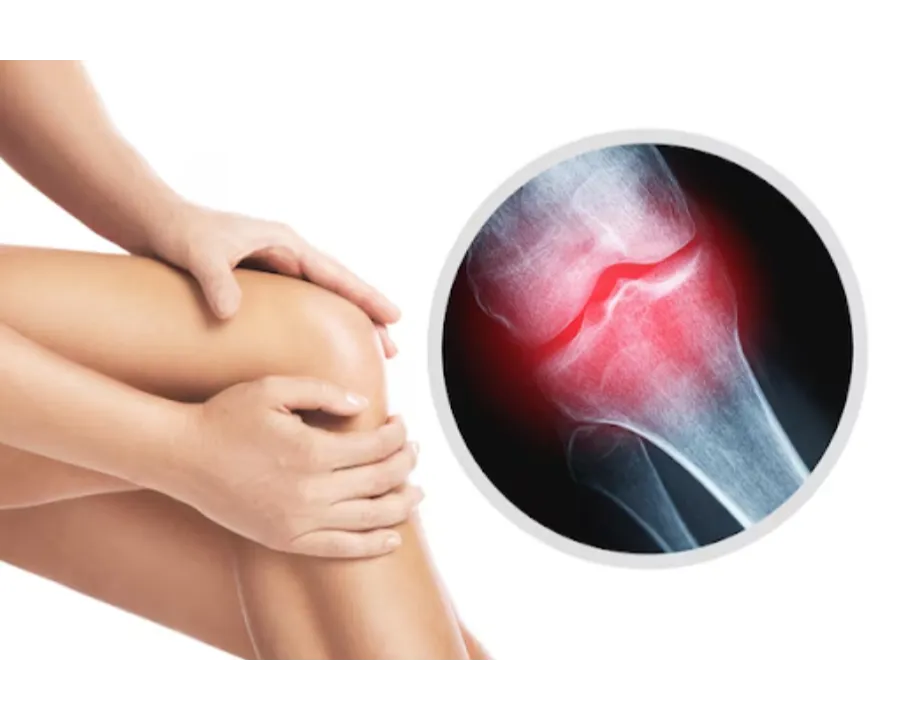 Osteoarthritis Treatment in Noida – Managing Pain with Expert Care