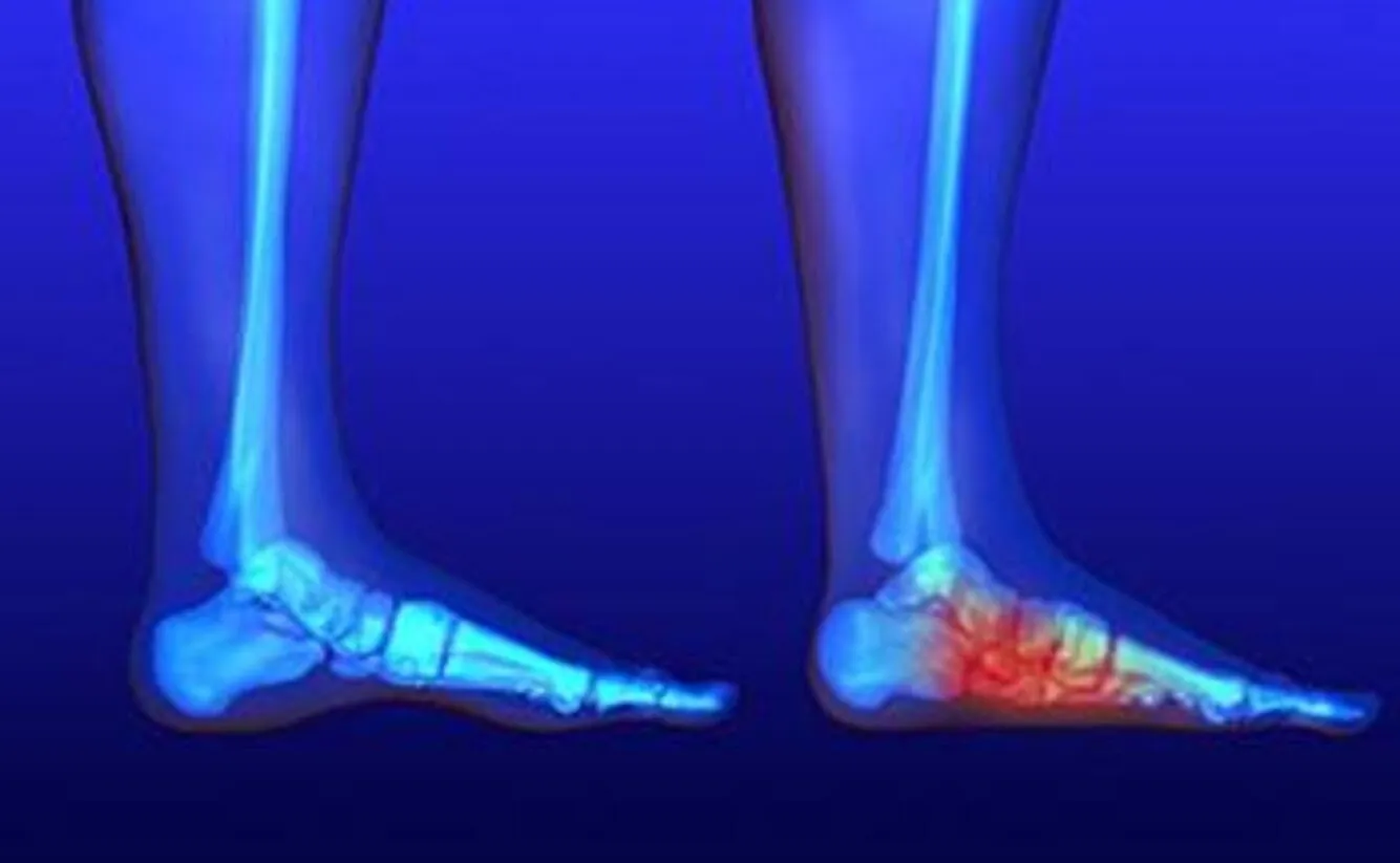 Deformity Correction in Pimpri-Chinchwad