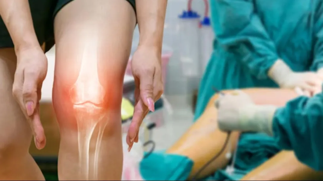 Best Doctor for Revision Knee Replacement in Delhi