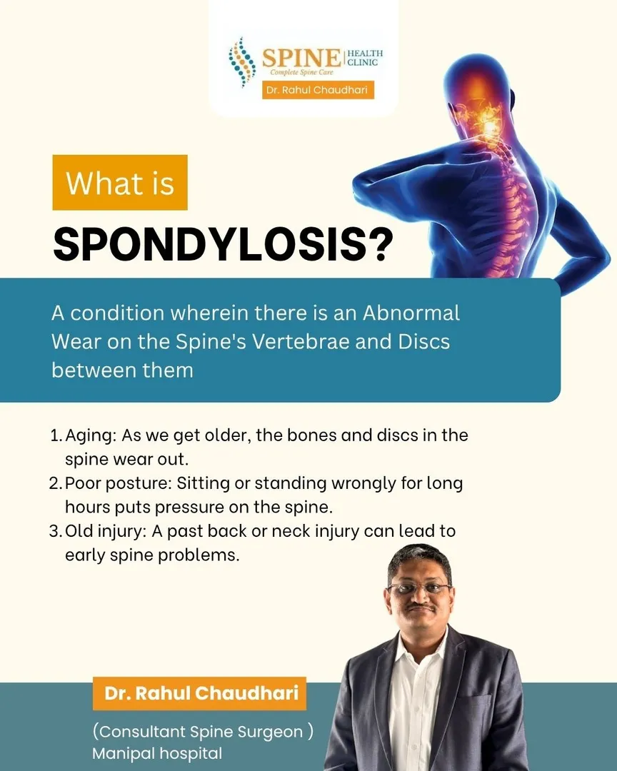 Spondylosis is the natural wear and tear of the spineโs bones and discs a condition that develops sl...