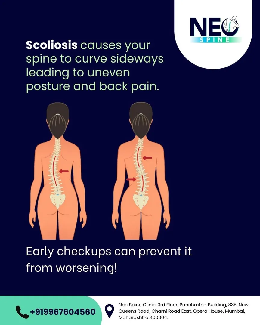Understanding Scoliosis and Its Impact on Your Spine
Scoliosis causes your spine to curve sideways, ...