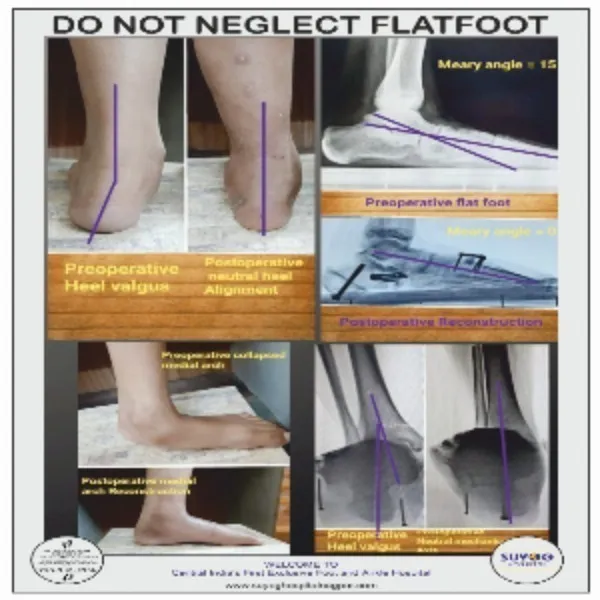 Expert Orthopedic Care in Nagpur – Advanced Solutions for Bone & Joint Pain