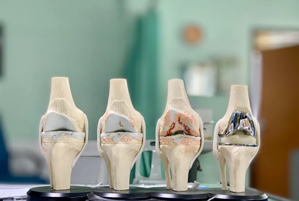 Joint Replacement in Palavakkam