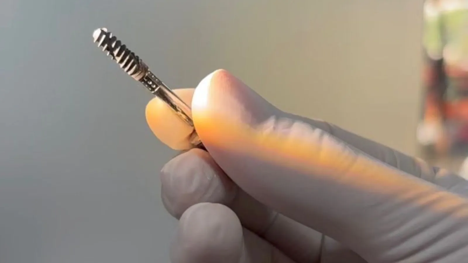 Is Dental Implant Painful?
