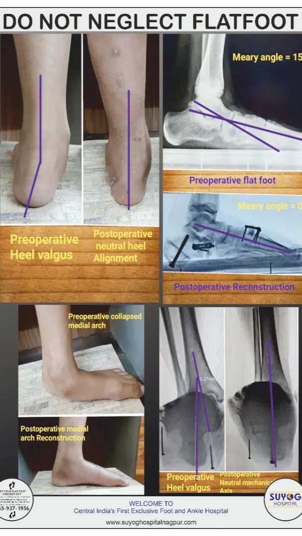 Top Orthopedic Surgeon in Nagpur – Helping You Regain Mobility & Live Pain-Free