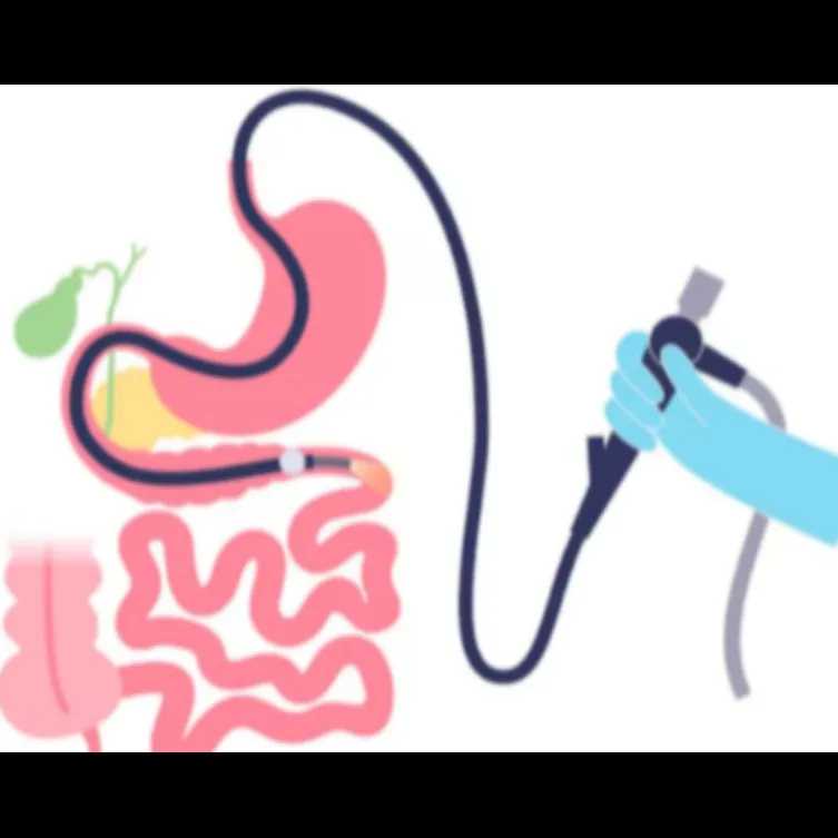 Double Balloon Enteroscopy in Mumbai