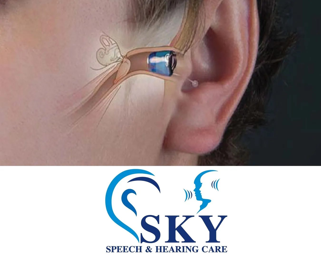 Speech Therapy in Coimbatore
