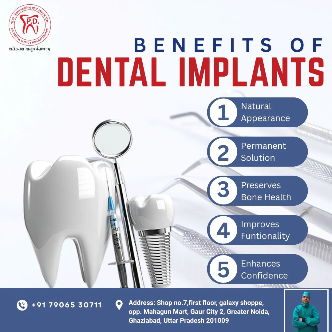 Dental implants