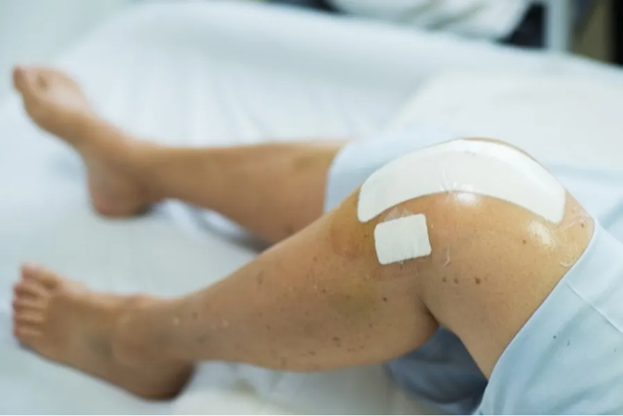 Knee Joint Preservation in Nagpur – Keeping Natural Joints Healthy