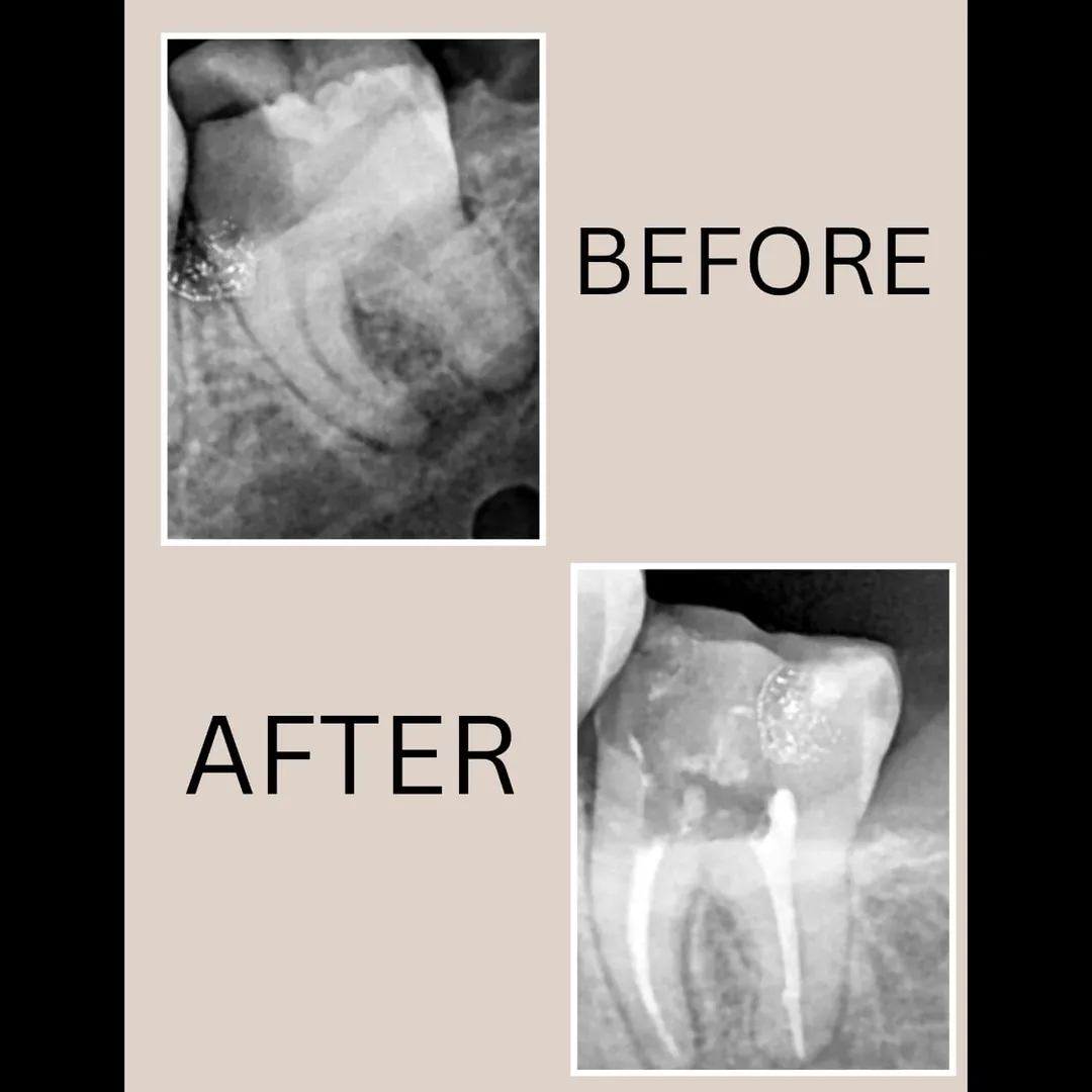 How Digital X-Rays Improve Diagnosis and Safety