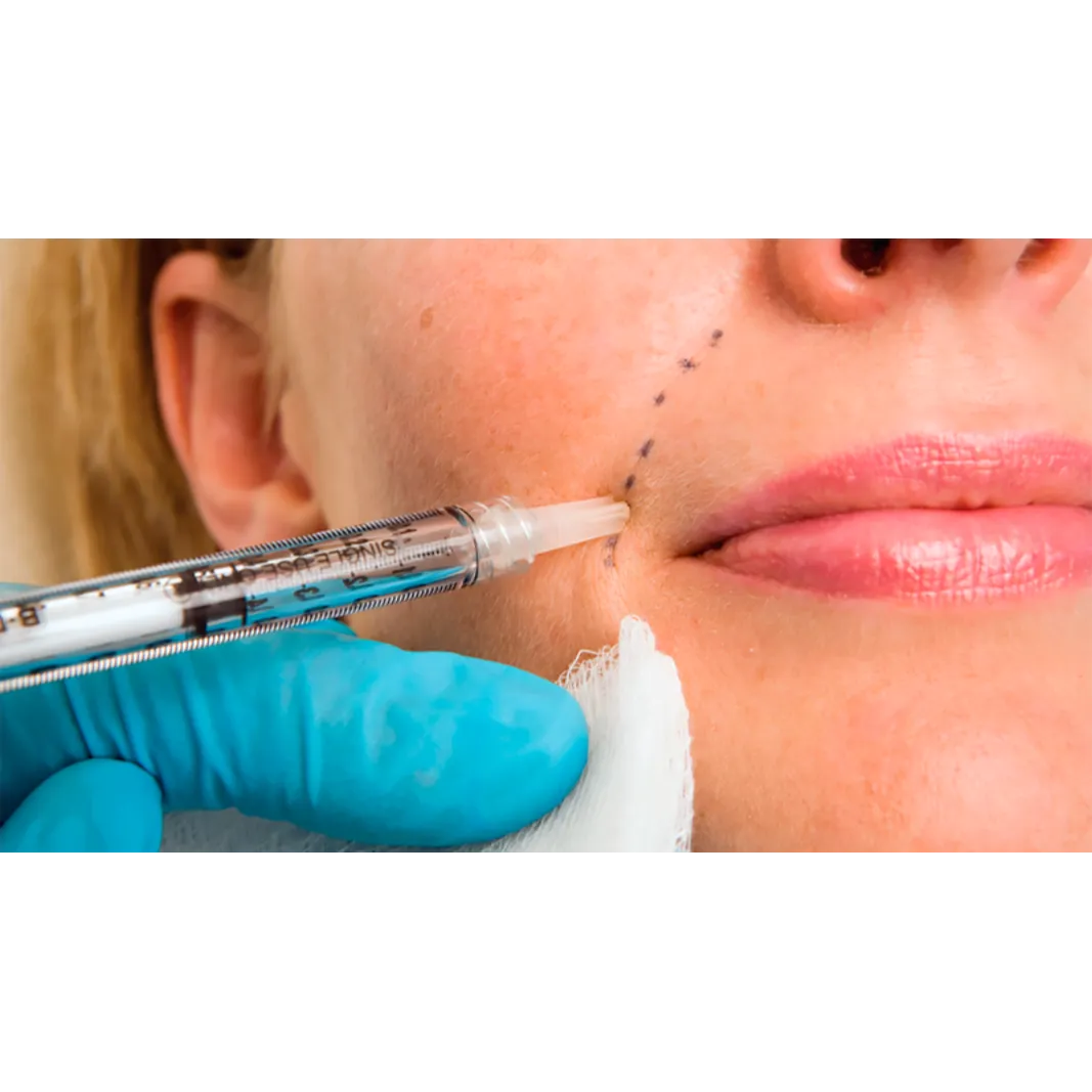 Dermal Fillers in Delhi