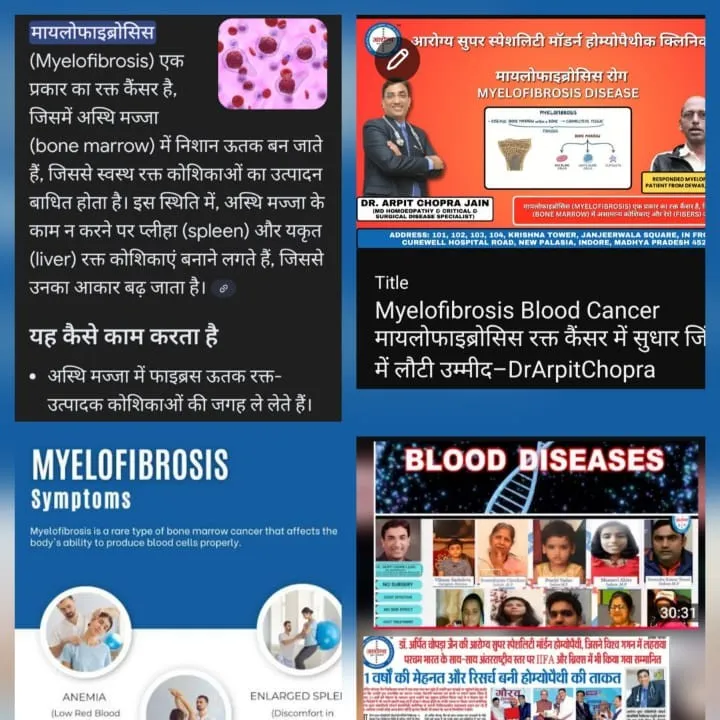 रक्त Blood Heamatology Aplastic Anaemia ITP Sickle Cell Anaemia,MDS,Blood Cancer treatment by Dr Arp...