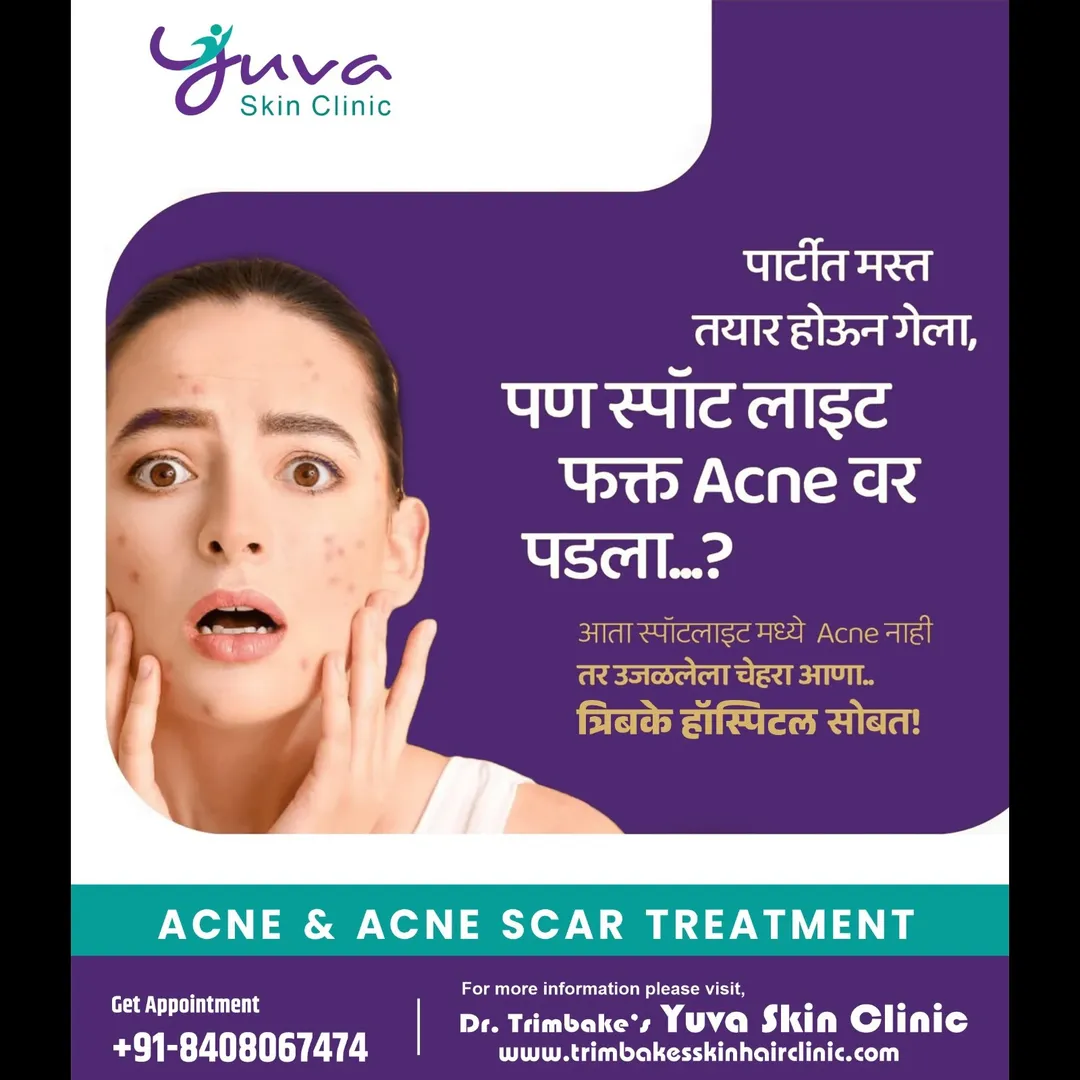 Acne & Acne Scar Treatment
Acne can be a nightmare for many. Many times, when an acne on your skin g...