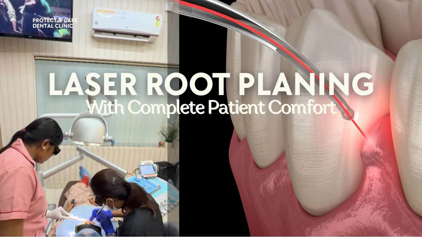 Laser Root Planing With Complete Patient Comfort in Anna Nagar, Chennai
