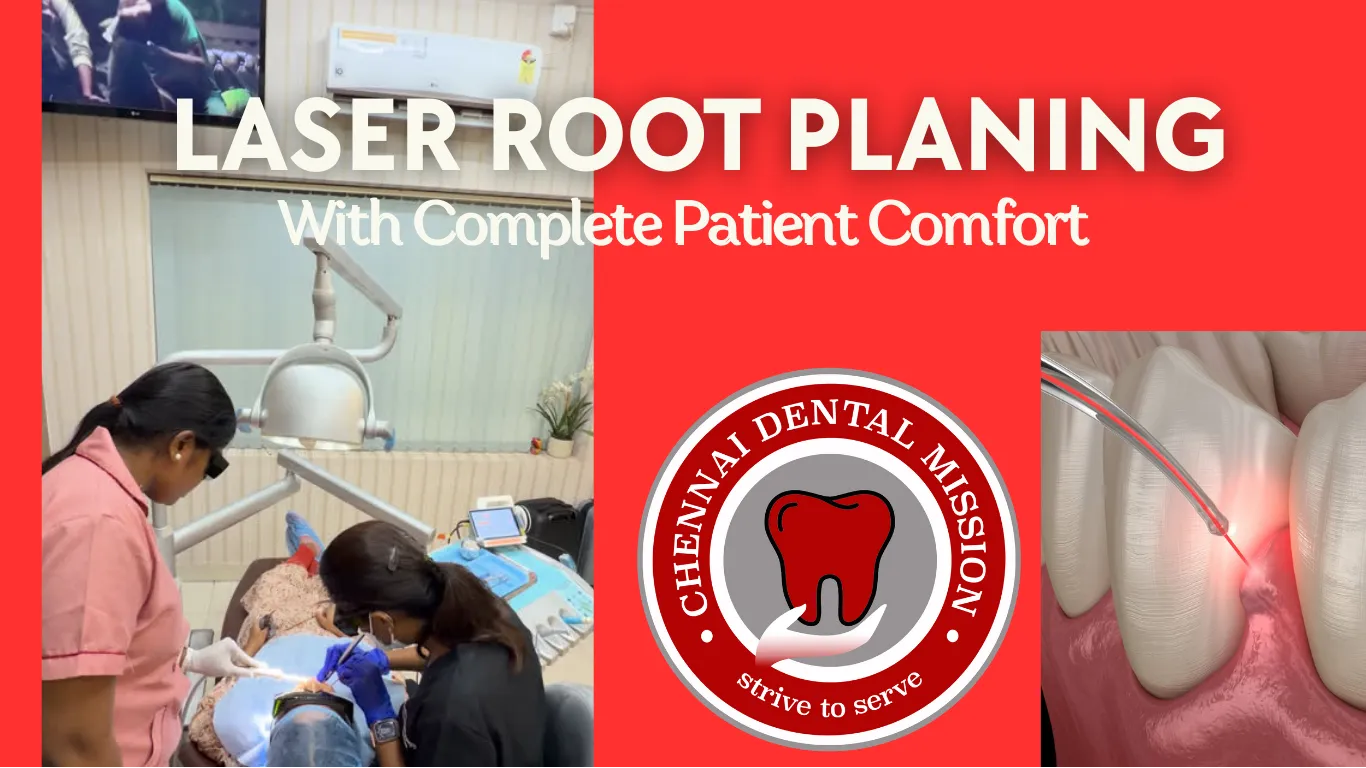 Laser Root Planing With Complete Patient Comfort in Anna Nagar, Chennai