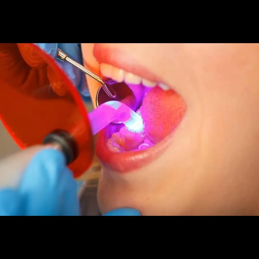 Enhance Your Smile with Cosmetic Tooth Filling At Dr. Jain’s Multispeciality Dental Clinic, Nagpur