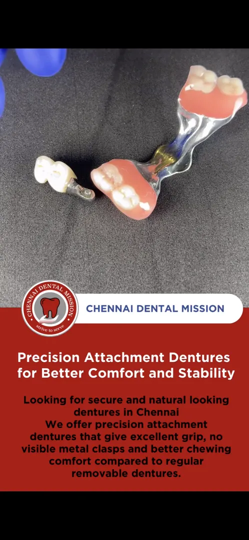 Precision Attachment Dentures for Better Comfort and Stability