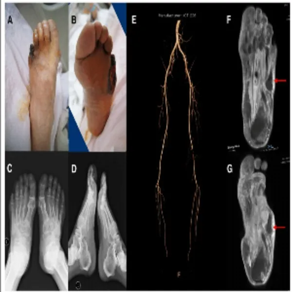 Best Orthopedic Foot & Ankle Surgeon in Nagpur – Precision You Can Trust