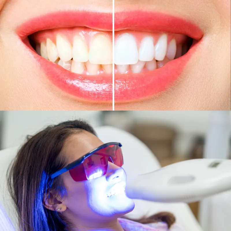 What to Expect on Your First Visit to Procare Dental LLP