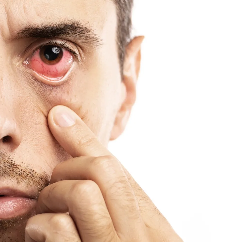 Redness Treatment in Byculla – Understanding What Your Eyes Are Telling You