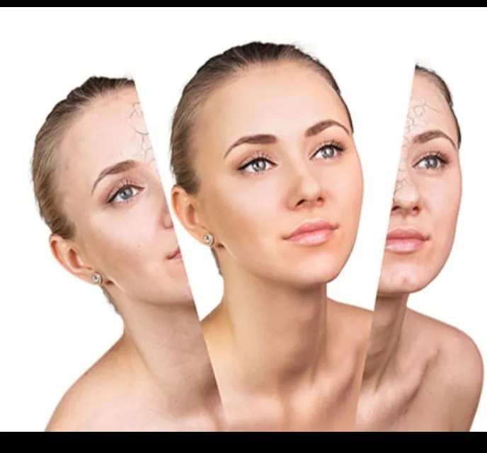 Skin Lightening Treatment in Delhi