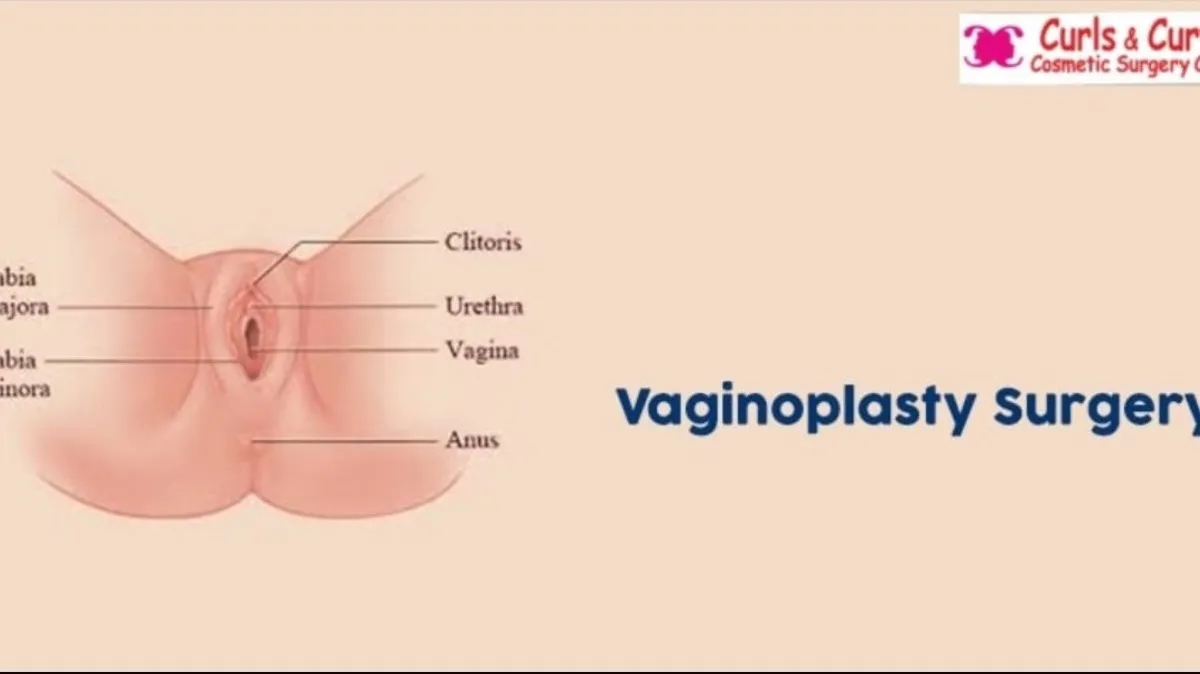 Vaginal Tightening in Bangalore – Restore Confidence and Comfort