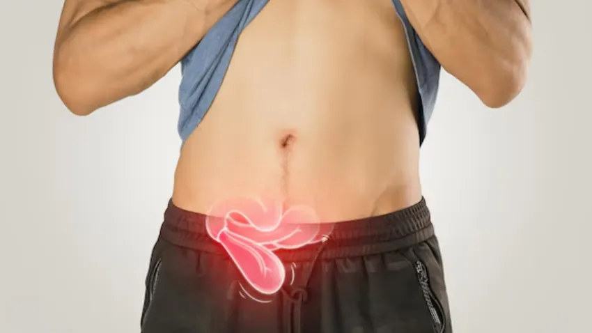 Safe and Effective Laparoscopic Hernia Surgery in Vashi
