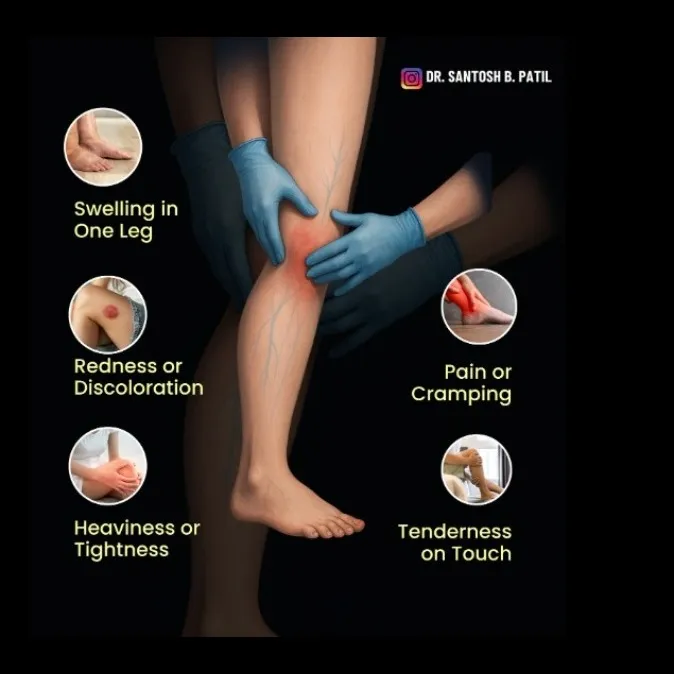 Best Varicose Veins Treatment in Pune | Best Vascular Surgeon in Pune | Dr Santosh Patil |