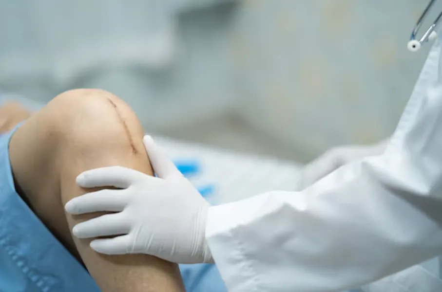 Infected Knee Replacement Surgery in Delhi NCR
