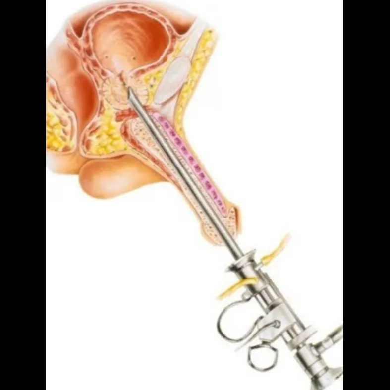 Prostate Surgery in Thane – Advanced Treatment Options