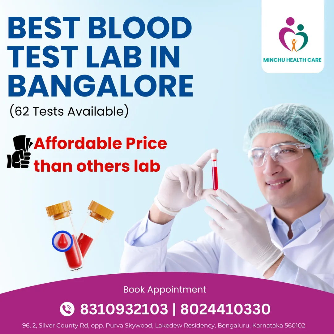 Best blood test lab Bangalore