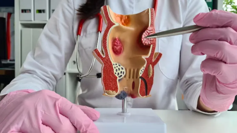 Expert Care by a Fistula Specialist in Pune