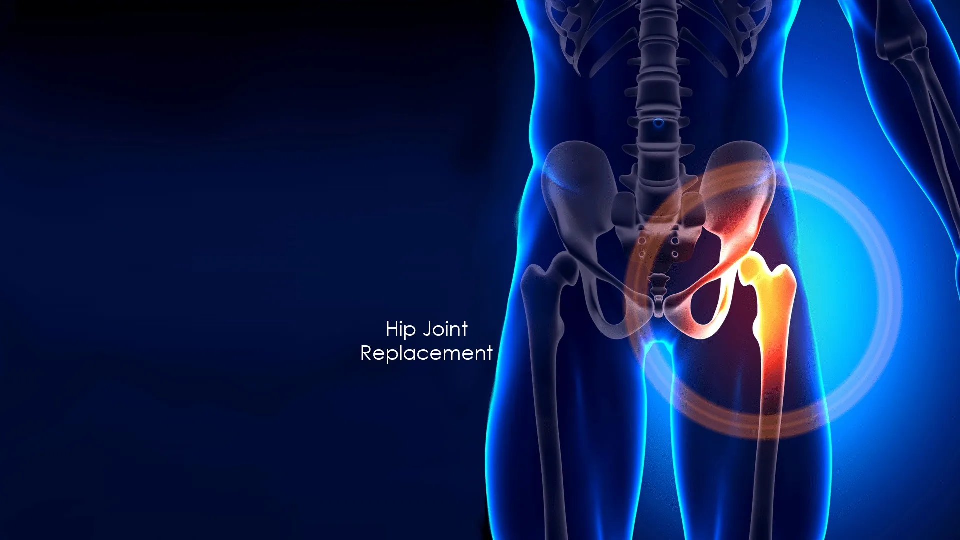 Best hip replacement doctor in South Delhi – thoughtful guidance for every stage of hip pain