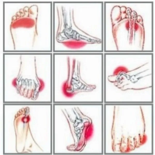 Trusted Foot and Ankle Orthopedic Care in Nagpur – Pain Relief & Healing