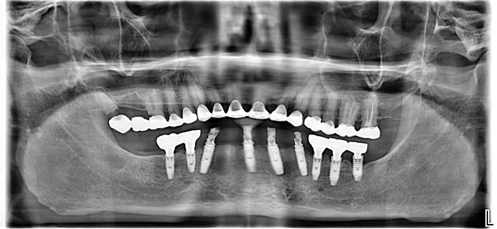 Our Digital Dentistry Approach at Procare Dental