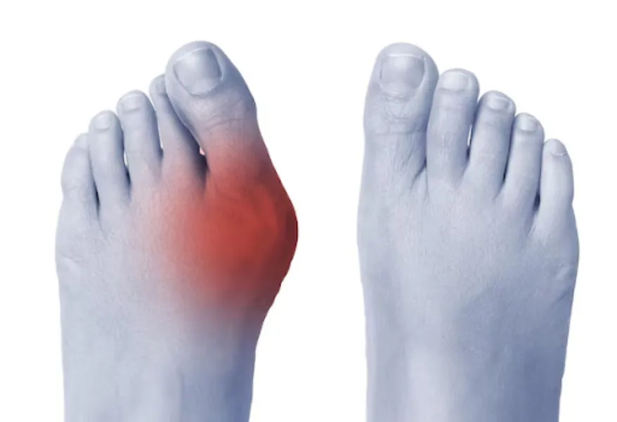 Best Orthopedic Doctor in Nagpur – Expert Care for Stronger Bones and Joints
