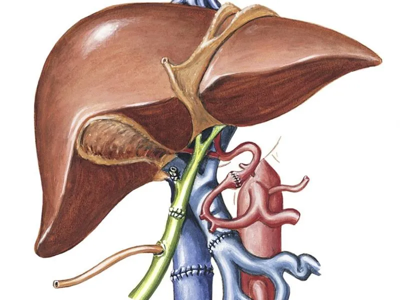 Expert Liver Doctor in Mumbai for Complex Liver Conditions