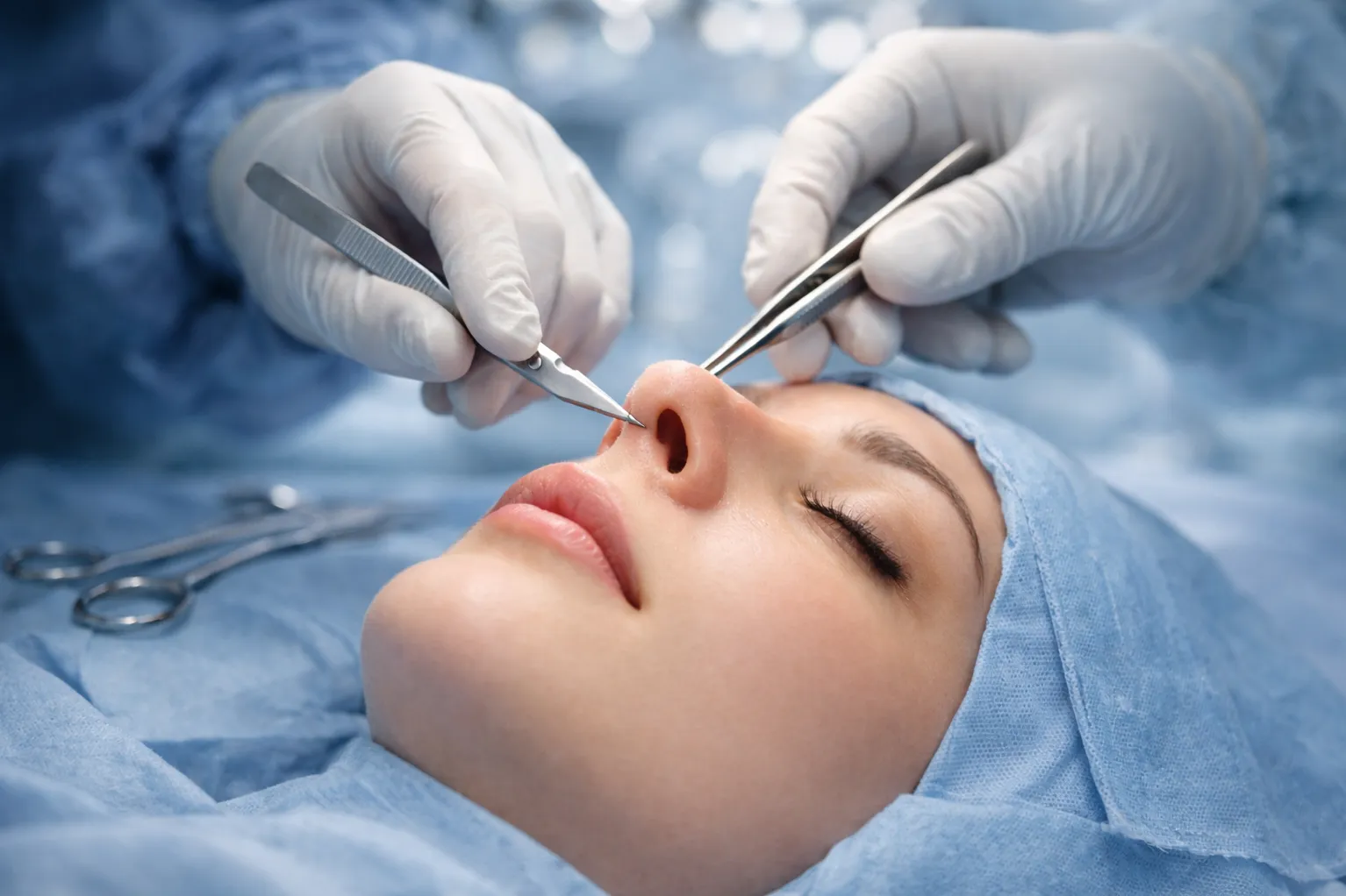Rhinoplasty in Delhi
