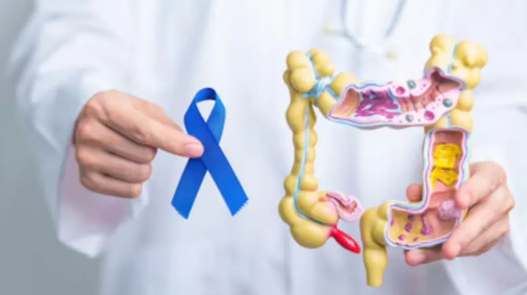 Robotic Colon Cancer Surgery in Yeshwanthpur – Enhancing Surgical Accuracy