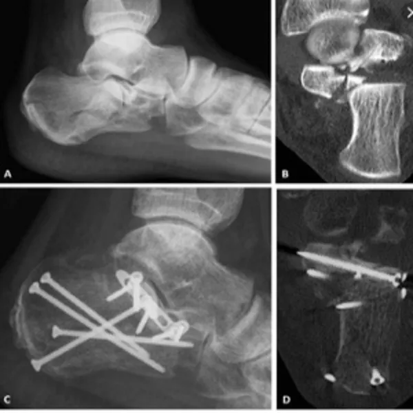 Best Orthopedic Surgeon in Nagpur for Joint Pain & Mobility Care