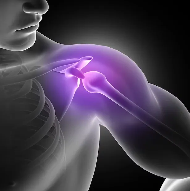 Reverse Shoulder Replacement in Bangalore – A Solution for Rotator Cuff Deficiency