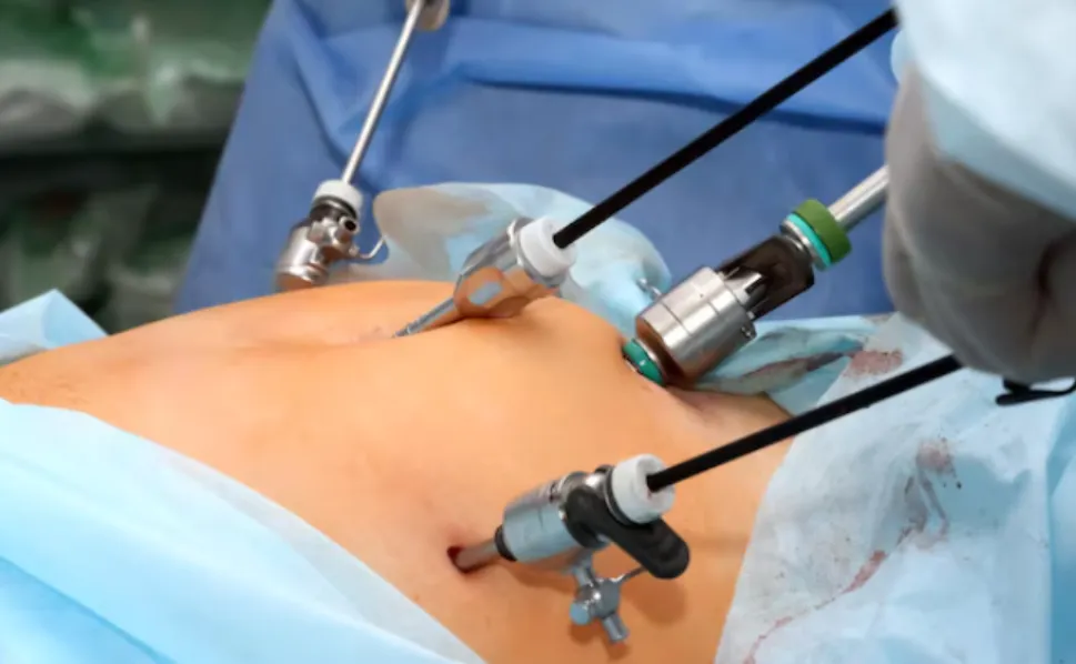 Laparoscopic Gynecology Surgeries in Nashik – Minimally Invasive Women’s Care