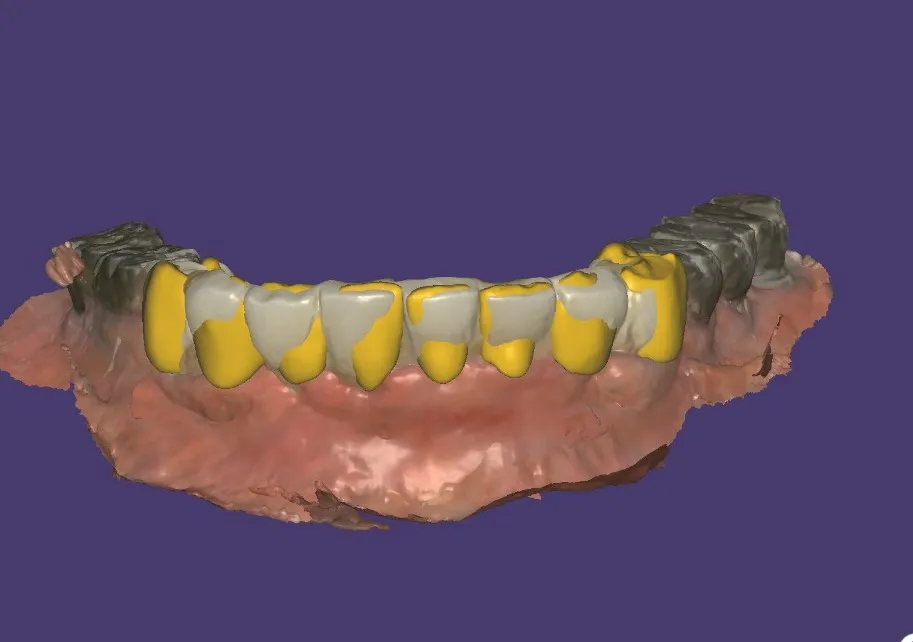 Our Digital Dentistry Approach at Procare Dental