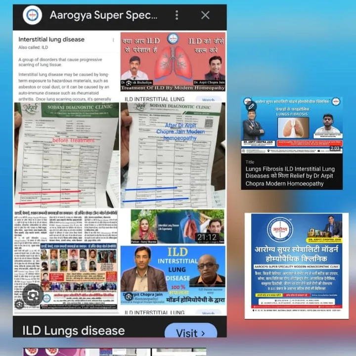 , For *online consultation* Payment of 1000 Rs for audio and 2000 rs for video at - Aarogya sup...