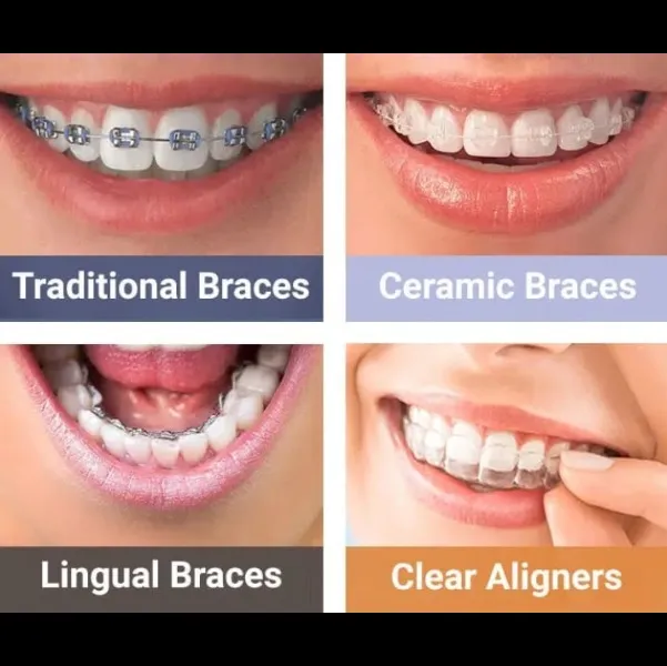 Best Orthodontic Treatment in Koparkhairane ✨