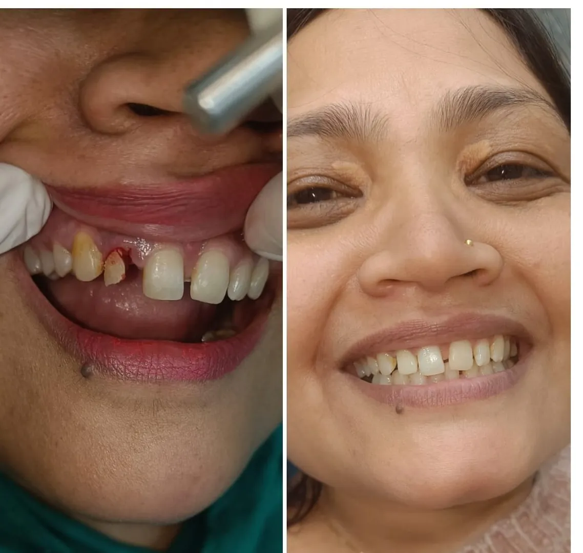 Best Dentist in Noida Extension - P.D.Dental clinic & Implant Center